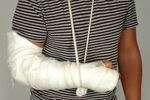 Odszkodowanie za złamaną rękę na śliskim chodniku